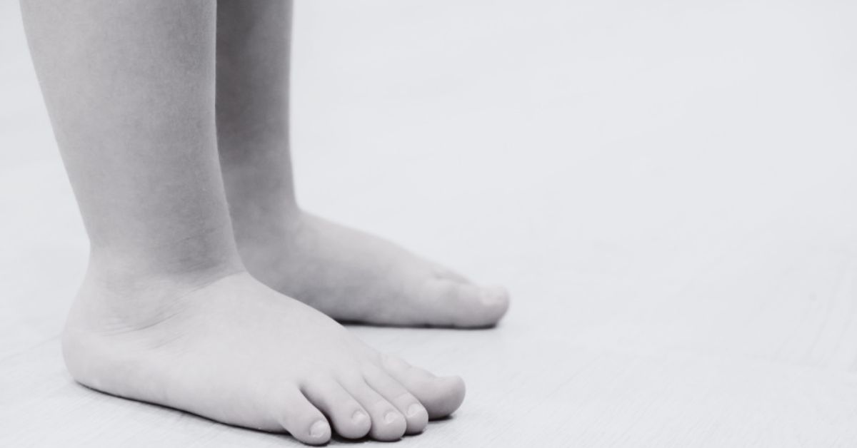 Niño de 5 años murió tras pisar accidentalmente cable con corriente en su casa