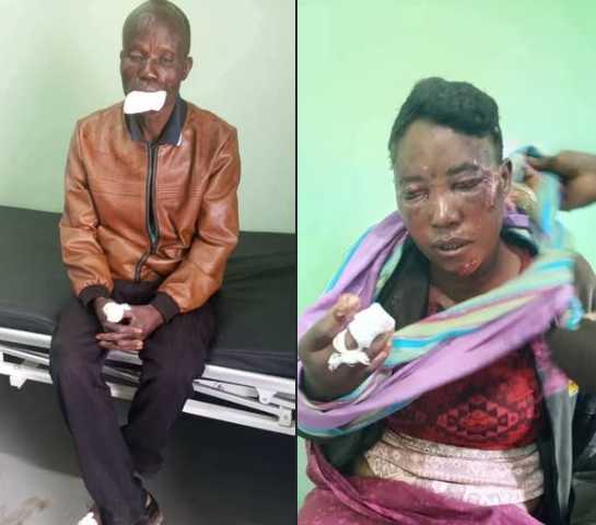 Zambian Couple Injure Each Other After Brutal Domestic Fight Over Livestock