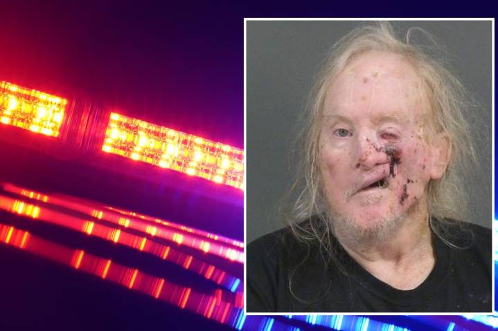 Man with grisly mug shot charged with multiple counts of sexual exploitation of a minor