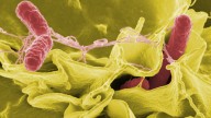 Intoxicación alimentaria en Murcia: más de 100 personas afectadas por salmonela con vómitos y diarreas