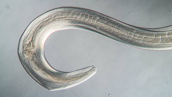 Sluggish Worm Found in Man's Eye After Months of Blurry Vision