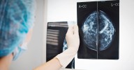New study reveals how fat cells can fuel cancer tumors