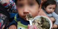 Anemia, desnutrición y sobrepeso: la triple amenaza que golpea a la niñez peruana y al desarrollo del país