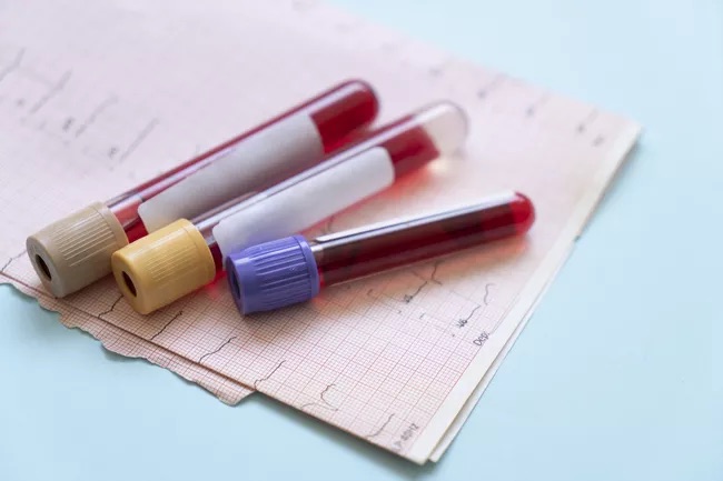 Oklahoma Cops Under Fire Over Racist Posts Promoting Blood Drive