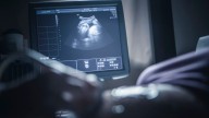 Another major medical association breaks from CDC as ob/gyn group recommends Covid
