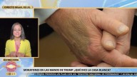La razón de la Casa Blanca para justificar el maquillaje en las manos de Trump