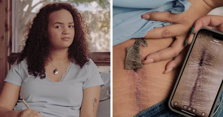 Her spine surgery was denied. Doctors say it's all too common.
