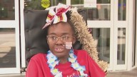 Shaker Heights cheerleader released from hospital weeks after leg amputation