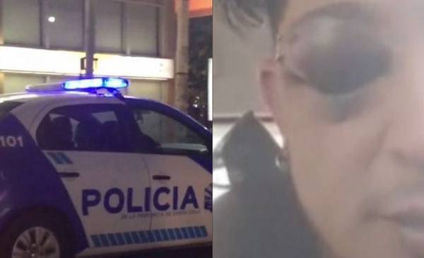 "Perdí este ojo": brutal golpiza de la Policía a un famoso cantante