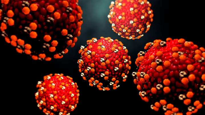 9 measles cases reported in Oconto County, Wisconsin's first cases of 2025