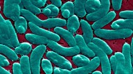 Flesh-eating bacteria cases are rising. Climate change is to blame, say scientists