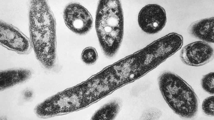 What is Legionnaires' disease and how does it spread?