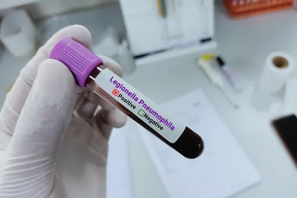 Central Harlem Legionnaires’ outbreak slows as city reports 7 new cases
