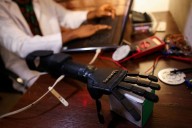 Nigerian firm develops bionic arms for amputees