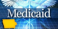 State of Iowa to award dental contracts to support Medicaid patients