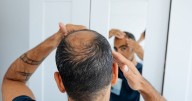 Common habit that millions still do is 'increasing your chances of going bald'