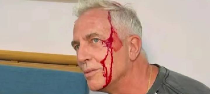 Marley se accidentó en Tailandia: "Quedé chorreando sangre"