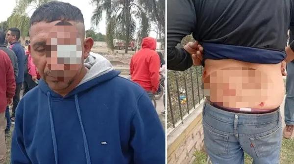 Conflicto municipal en Hipólito Yrigoyen: Un empleado perdió un ojo y hay otros heridos
