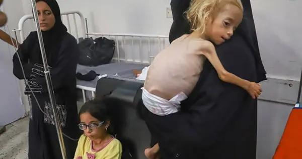 Niños en Gaza,sin fuerza ni para llorar, dice ONG
