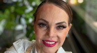 Carmen Campuzano es hospitalizada tras sufrir lesión en la nariz