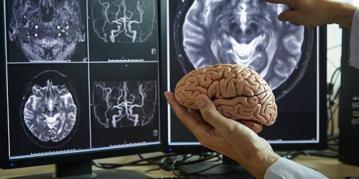 La terapia de conversación altera la estructura del cerebro, según muestran las resonancias magnéticas