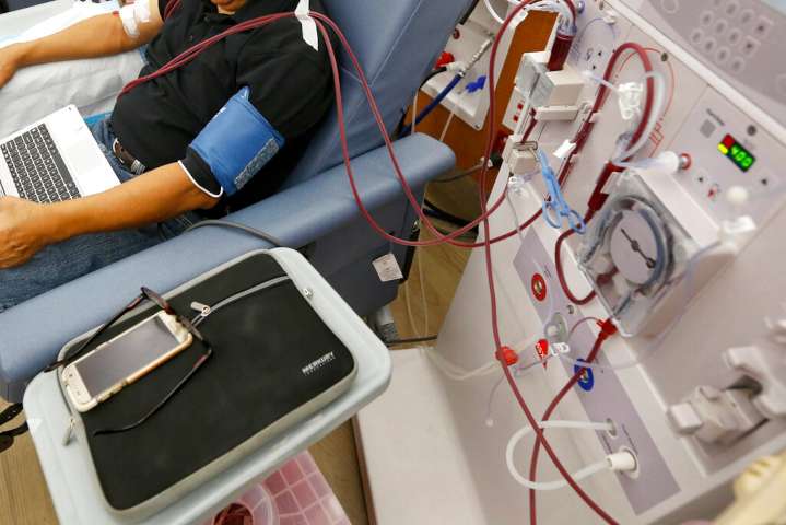 Rep. Mannion, back kidney donation bill that would save hundreds of lives (Guest Opinion by Grant Bille)