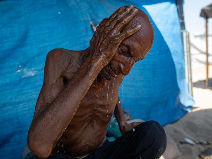 What ‘starvation’ really means, for the human body and for Gaza