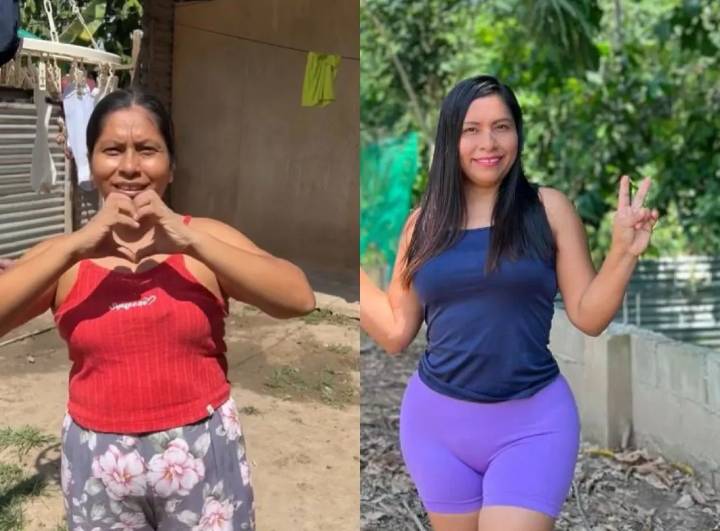 Lis Padilla, la influencer de “Amores que matan, pum pum pum”, pasó por el quirófano y quedó irreconocible