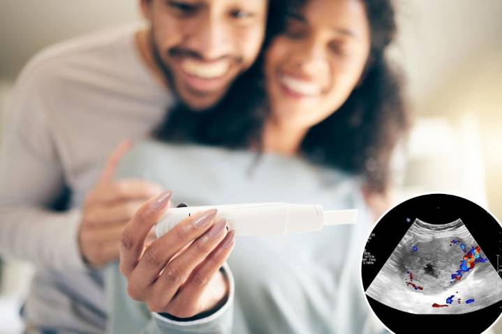 This rare cancer can give you a false positive pregnancy test