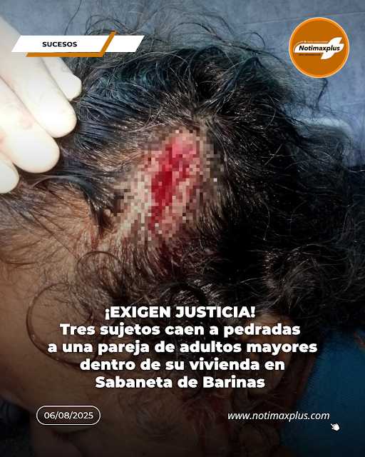 ¡Exigen justicia! Tres sujetos caen a pedradas a pareja de adultos mayores dentro de su vivienda en Sabaneta de Barinas