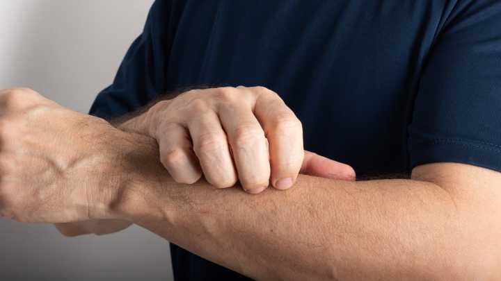 The Commonly Mistaken Sign Of Shingles You Shouldn't Ignore
