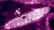 NYC Legionnaires' disease cluster: Over 100 cases, 4 deaths