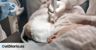 El procedimiento exprés que corrige la vista sin bisturí y elimina las gafas para siempre