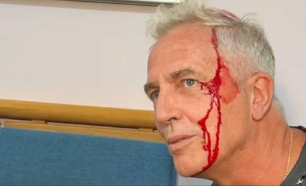 Marley sufrió un accidente en Tailandia y se abrió la cabeza