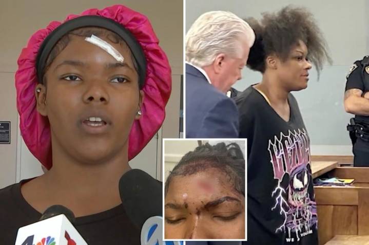 Exclusive | Long Island teen attacked with metal 'Stanley' mug speaks out