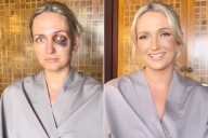 Bride's Wedding Day Saved by Makeup Miracle After Accident Leaves Her with Black Eye