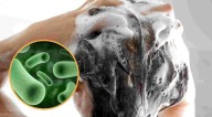PROFECO alerta por shampoo contaminado; puede provocar infecciones oculares, nasales y en la piel