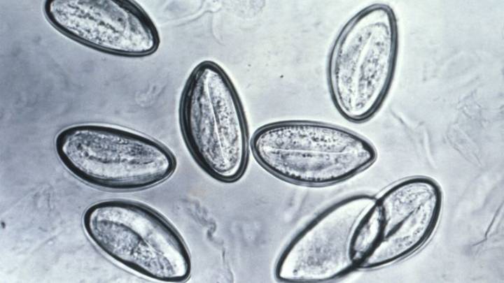 Do you need to cleanse your body of parasites? A doctor explains the social media fad