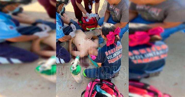 Motociclista resultó gravemente herido al impactarse con auto en Altamira