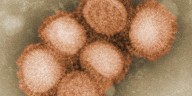 Respiratory viruses like the flu and COVID can trigger dormant cancers, research suggests
