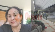 UN HOMBRE Y UNA MUJER RESULTAN HERIDOS EN ATAQUE TIPO COMANDO SICARIAL EN YOPAL. FUERON REMITIDOS A HOSPITAL