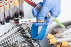NYC Legionnaires’ Outbreak: 6 Deaths, 112 Cases