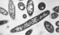 What to know about Legionnaires' disease, which has sickened dozens in New York City