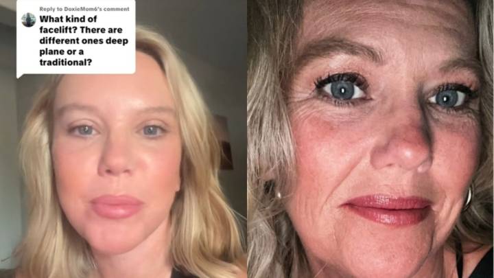 Mujer rejuvenece 20 años gracias a un lifting, la confunden con una adolescente en sus redes