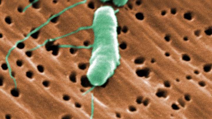 Emiten alerta por raro caso de “bacteria come carne” en Massachusetts