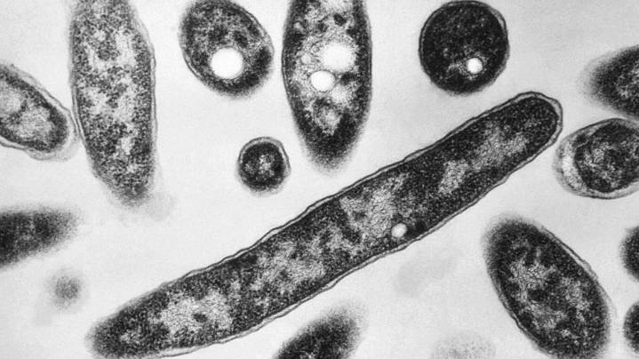 What to know about Legionnaires' disease, which has sickened dozens in New York City