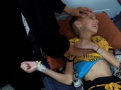Tens of thousands of Palestinian children starving in Gaza tent camps