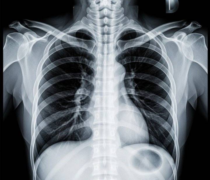 New Radiologic Technology Lab being unveiled Tuesday at YSU