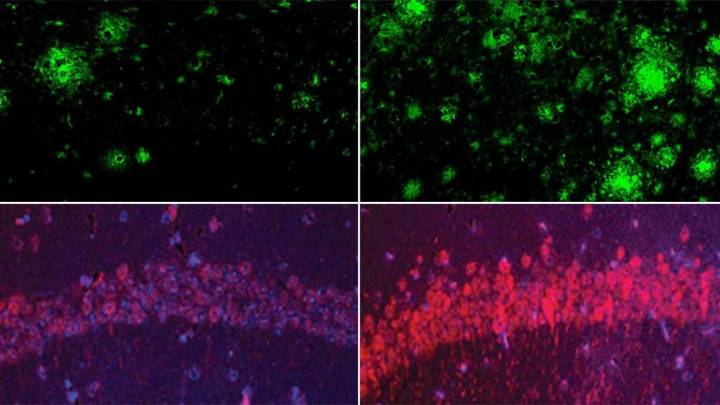 El litio, una nueva esperanza para revertir el Alzheimer