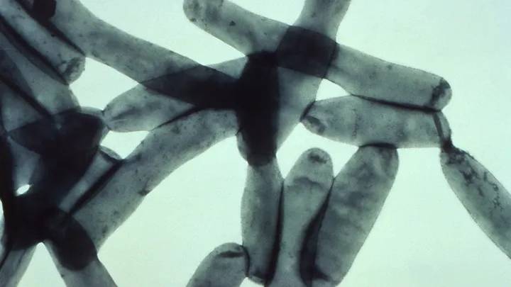 What is Legionnaires' disease? Symptoms, what to know amid NYC cluster